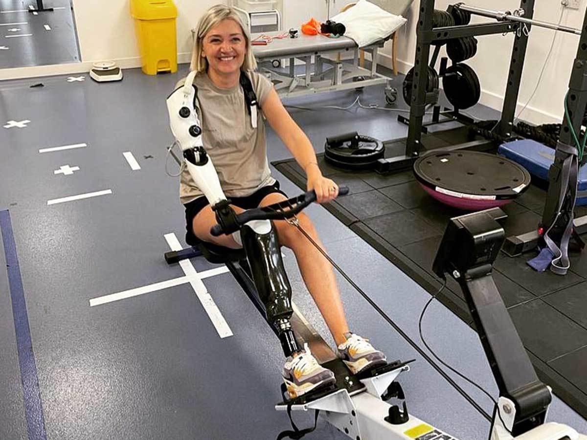  Sara postaje prva osoba sa bioničkom rukom koja čita misli - Instagram / @sjdelagarde 