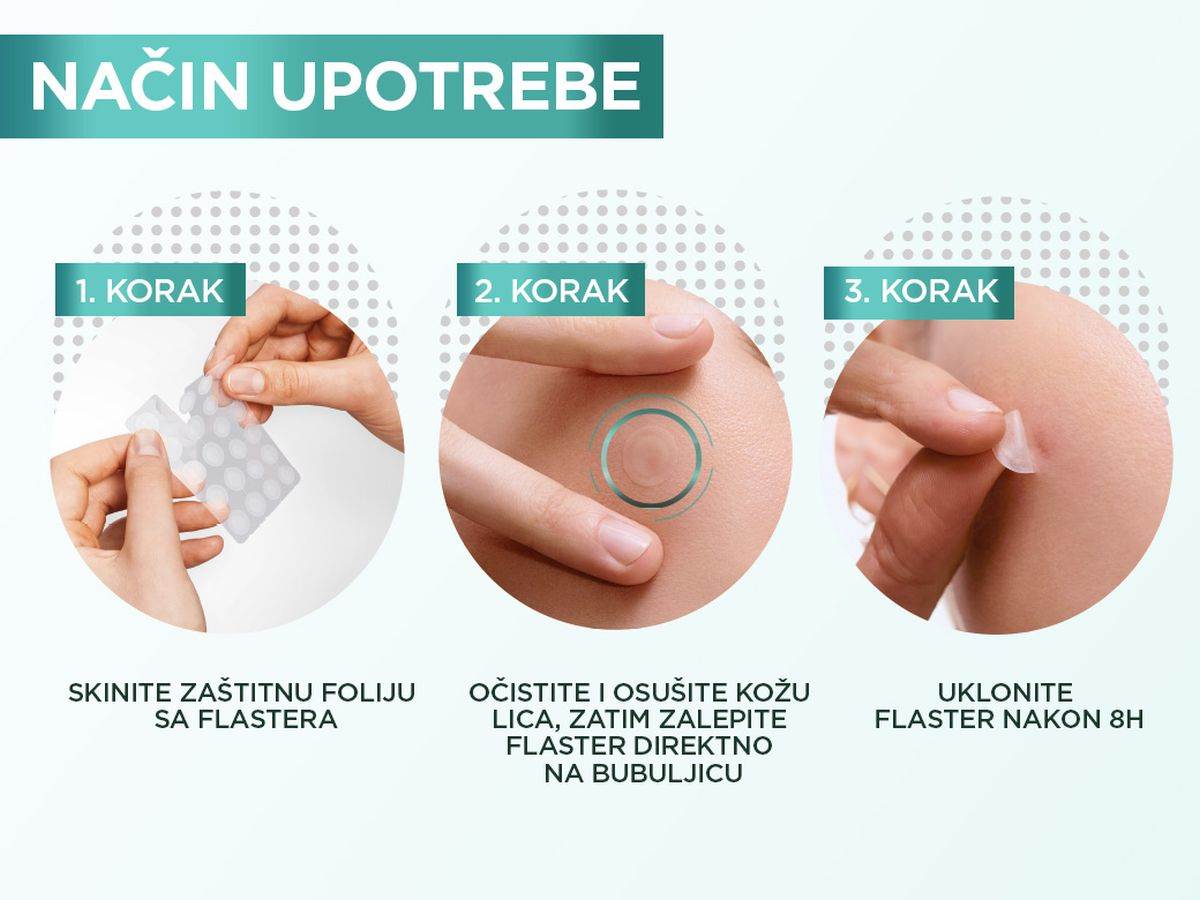  2 GAR-PimplePatch.jpg - Garnier 