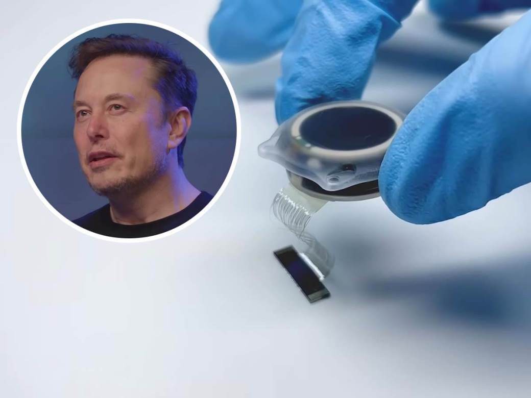  Neuralink masovna proizvodnja 