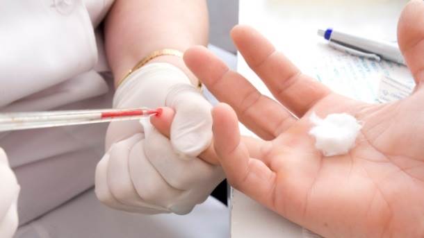  Imate viši nivo dobrog (HDL) holesterola. Dobar holesterol povezan je sa nižim rizikom od bolesti srca i kardiovaskularnog sistema uopšte. Za ovo možete da zahvalite estrogenu. 