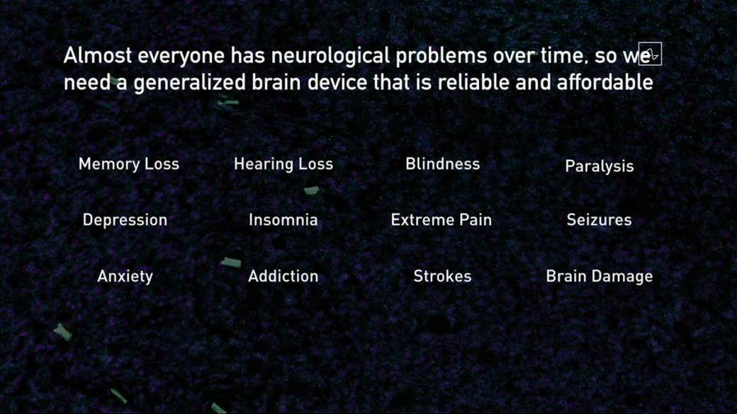   - MONDO / ScreenShot / Neuralink 