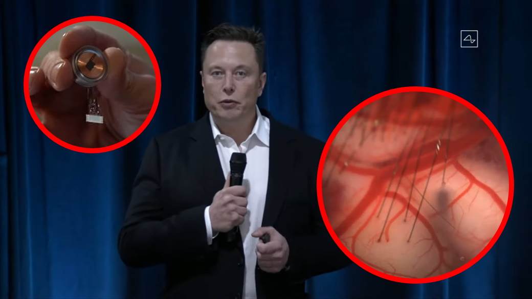   - MONDO / ScreenShot / Neuralink 