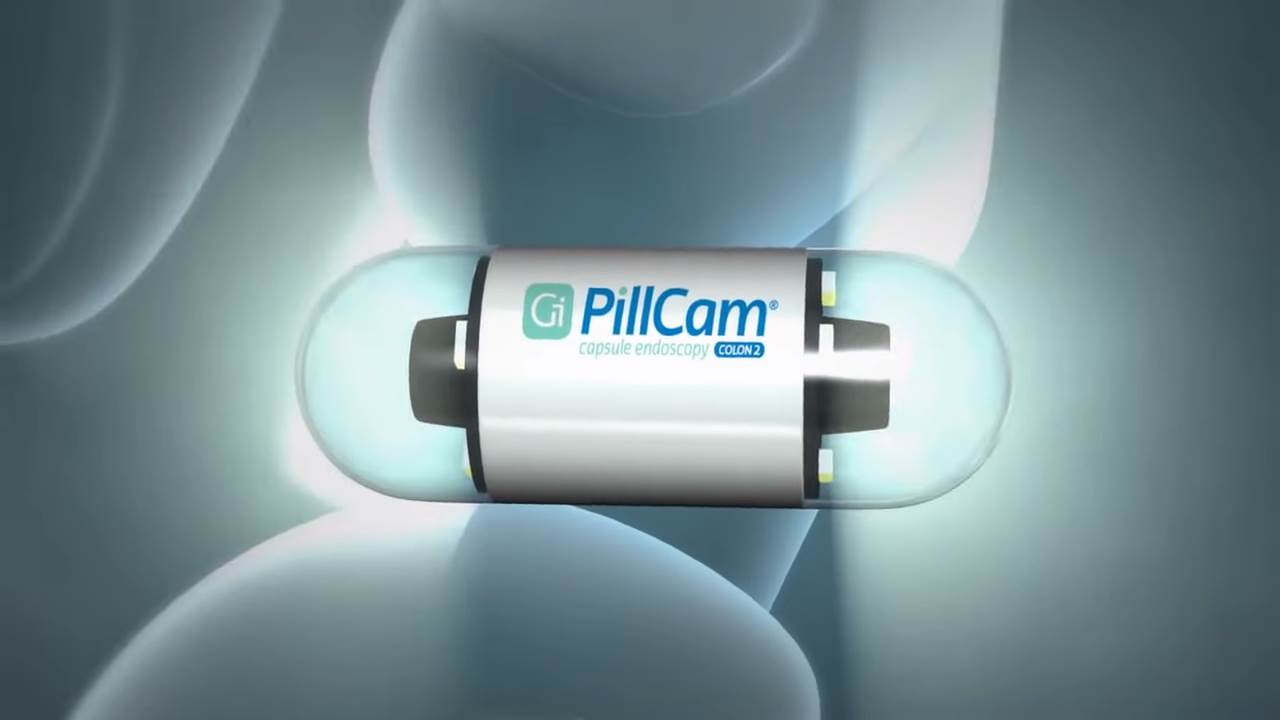   - YouTube / Printscreen/ Medtronic Deutschland 