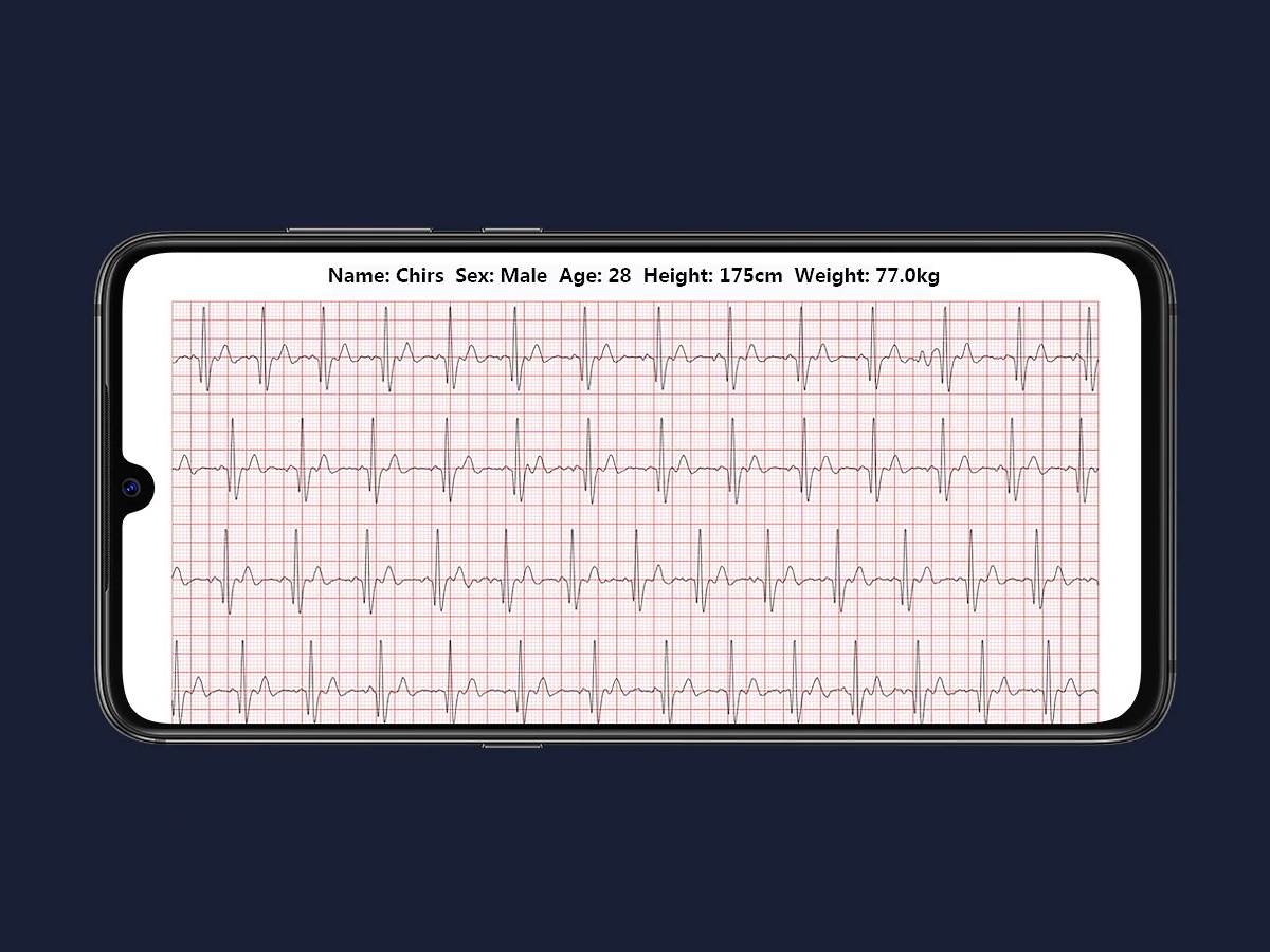   - SMARTLife / Xiaomi 