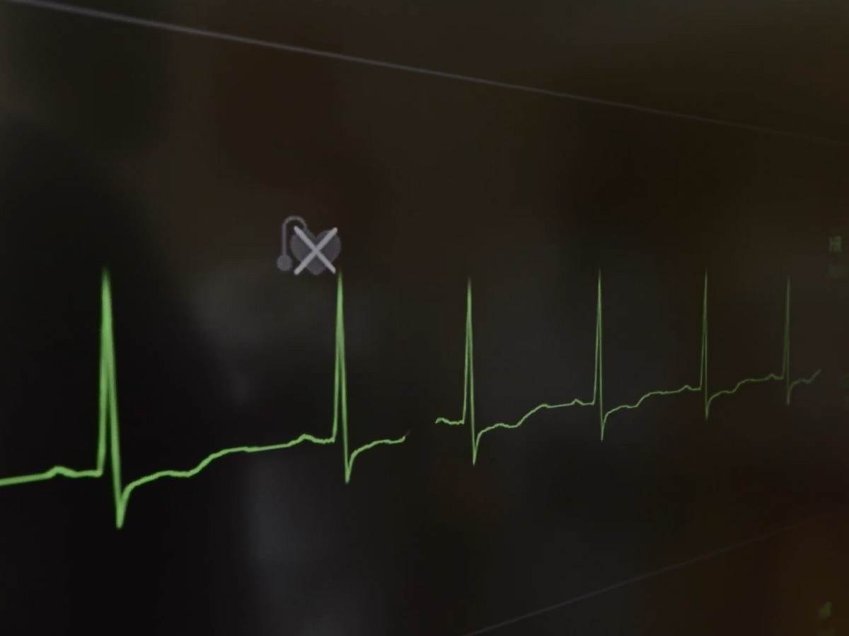  Heart Net mreža 1 - SmartLife / Heart Net 