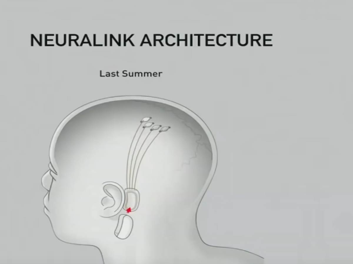 Neuralink.jpg - Smart Life/Neuralink   Neuralink.jpg - Smart Life/Neuralink