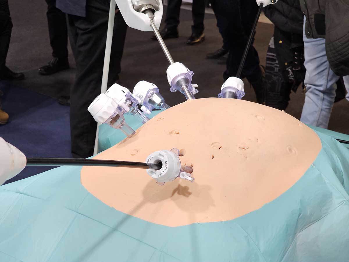 Bitrack hirurški robot 4.jpg - SmartLife / Ilija Baošić   Bitrack hirurški robot 4.jpg - SmartLife / Ilija Baošić