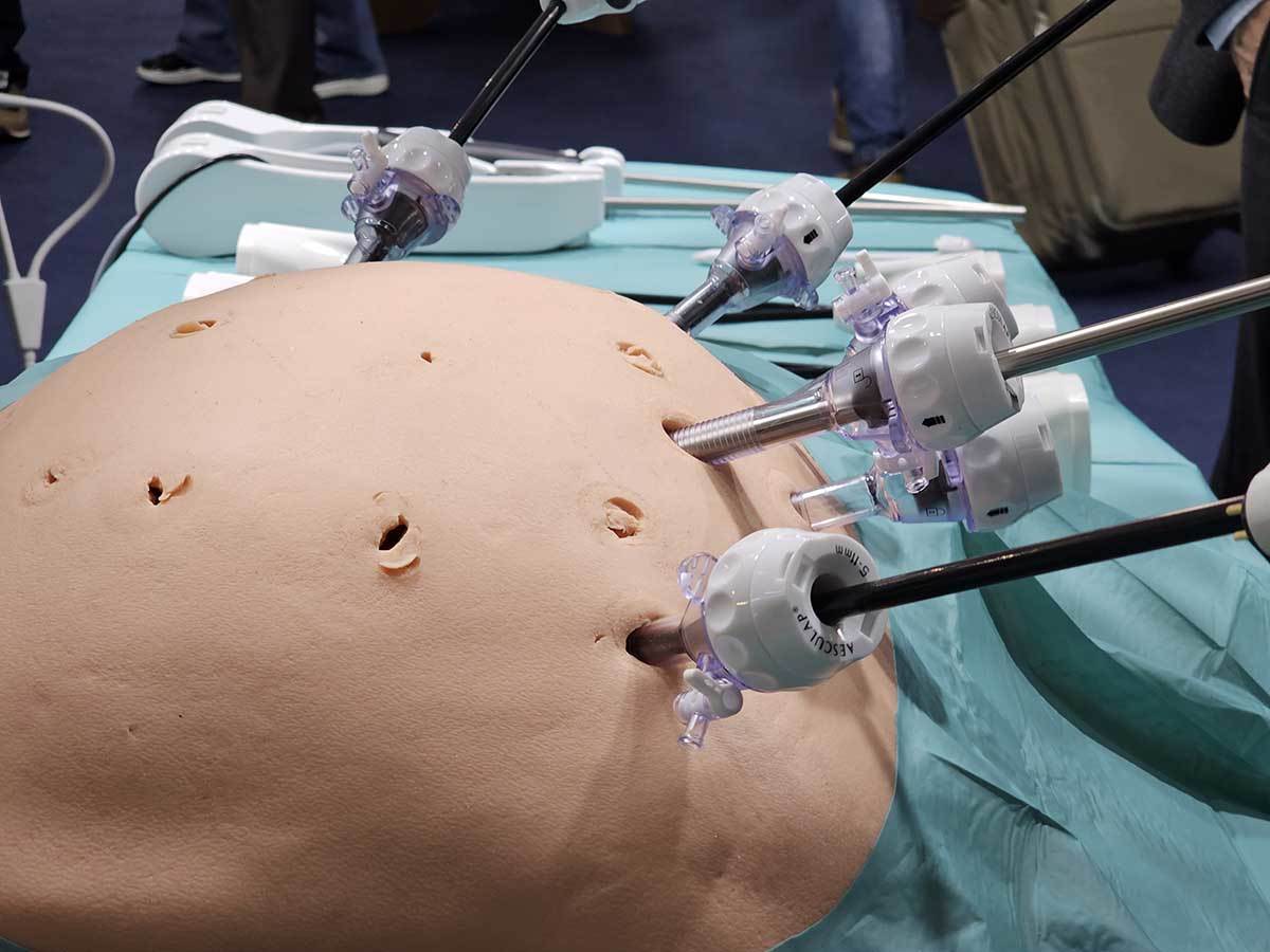 Bitrack hirurški robot 2.jpg - SmartLife / Ilija Baošić   Bitrack hirurški robot 2.jpg - SmartLife / Ilija Baošić