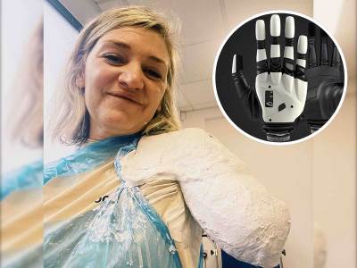 Sara postaje prva osoba sa bioničkom rukom koja čita misli  Sara postaje prva osoba sa bioničkom rukom koja čita misli