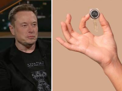 Ilon Mask i Neuralink implant Ilon Mask i Neuralink implant